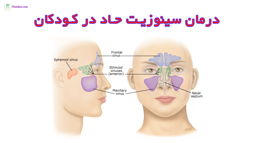 www.ninidata.com | ایا آنتی هیستامین ها و شستشوی بینی در درمان سینوزیت نقش دارد ؟