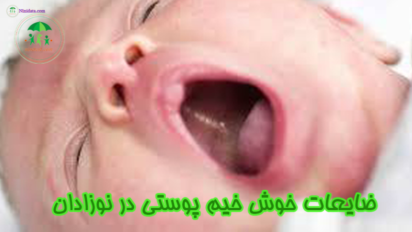 www.ninidata.com | پوست نوزادان