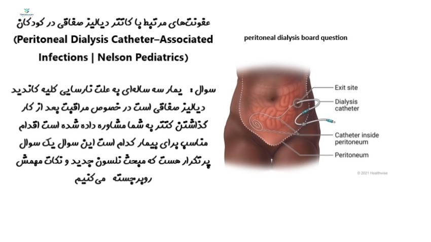 www.ninidata.com | عفونت‌های مرتبط با کاتتر دیالیز صفاقی در کودکان